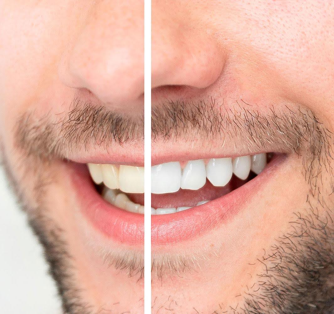 Cabinet de dentisterie esthétique à Neuilly-Plaisance